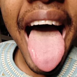 Person showing his tongue