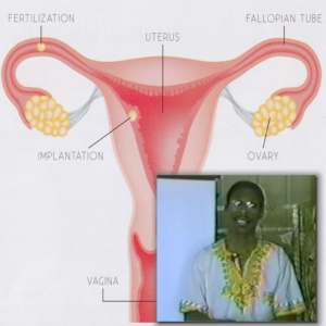 A picture of an african american woman and the uterus.