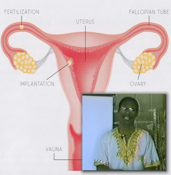 A picture of an african american woman and the uterus.